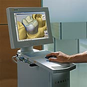 After CEREC