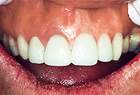A new CEREC smile