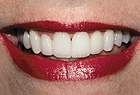 A new CEREC smile